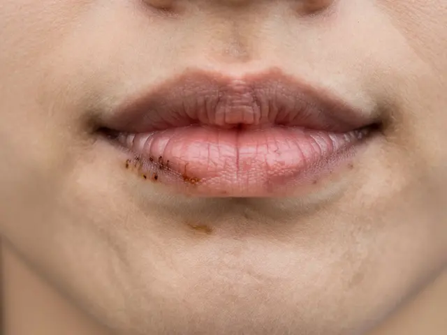 Jak černý zubní kámen ovlivňuje váš krk a co s tím dělat