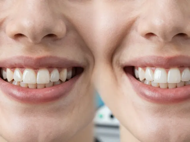 Před a po: Úžasné transformace s celokeramickými fazetami