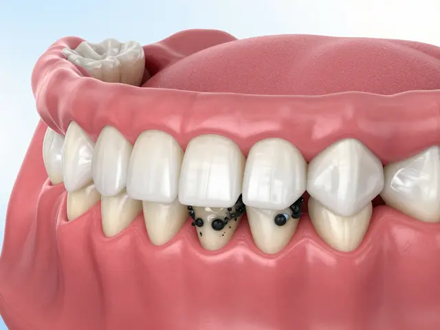 Černý zubní kámen a zápach z úst: Proč vzniká a jak se ho zbavit