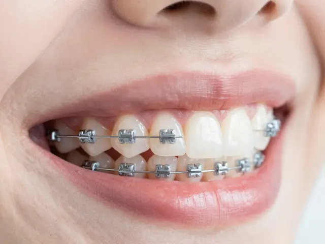 Jak se postarat o keramická rovnátka: Kompletní průvodce pro udržení krásného úsměvu