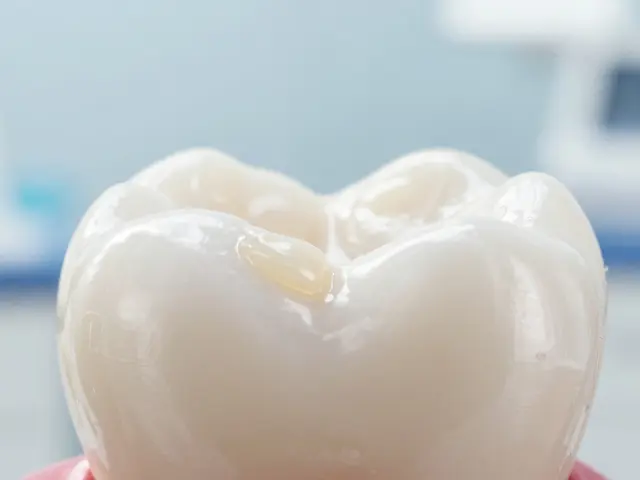 Jak zastavit počínající zubní kaz: Průvodce pro diabetiky