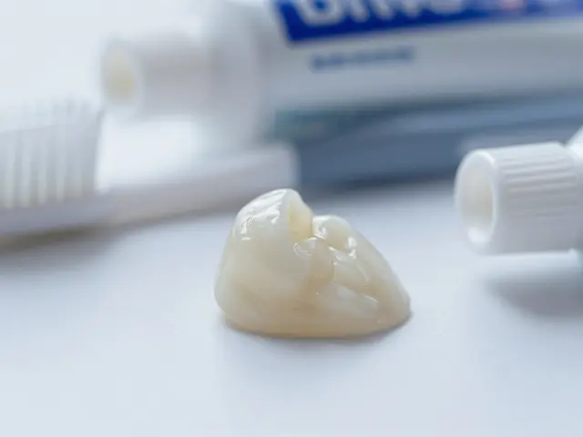 Jak pečovat o dentální vinyry: Kompletní průvodce pro dlouhou životnost