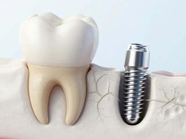 Zubní implantáty: Kompletní průvodce po procesech, cenách a péči v roce 2026
